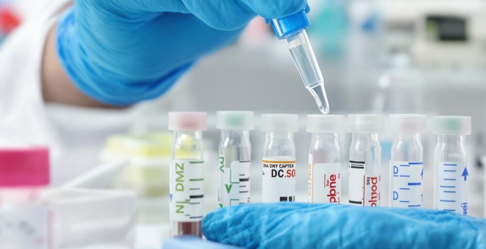 A gloved hand holds a dropper above several labeled test tubes in a laboratory setting, reminiscent of a CVS DNA paternity test. The tubes have colored caps and contain clear liquids, with various labels visible on the sides.